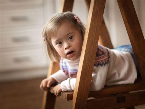 Health Supervision for Children With Down Syndrome