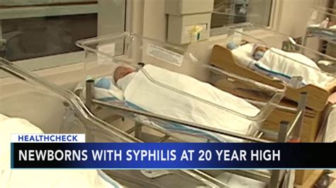 Health officials urge further testing after syphilis cases in US newborns soared in 2022
