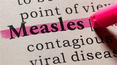 Health officials warn of possible measles exposures in St. Louis, St. Charles counties