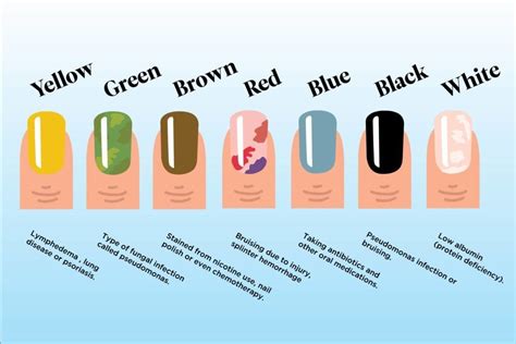 Healthy Nail Color Chart