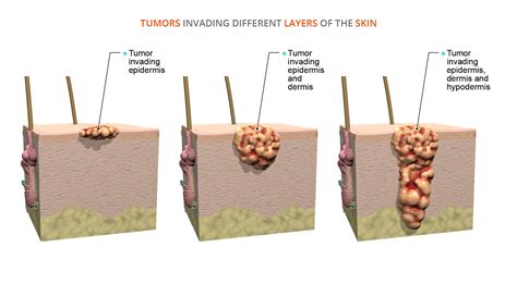 Healthy skin awareness: A closer look at the anatomy of the …