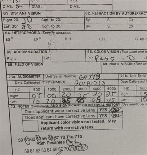 Hearing loss waiver. Anyone know what my chances are? 3k 45db …