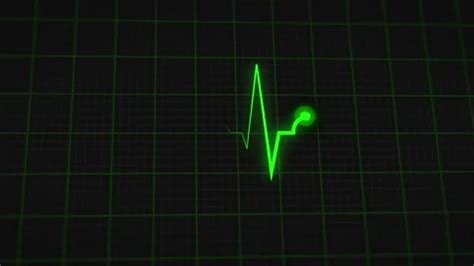 Heartbeat monitor line, seamlessly loop animation, green line …