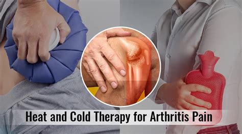 Heat or cold for arthritis When to use it and methods