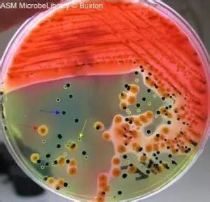 Hektoen Enteric (HE) Agar: Composition, Uses • Microbe …