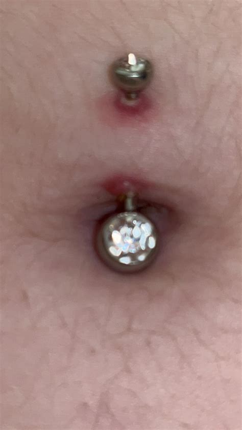 Help! Is my belly piercing infected or rejecting? : r/piercing