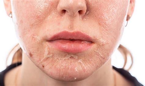 Help! My skin care products are burning my face! - myLot