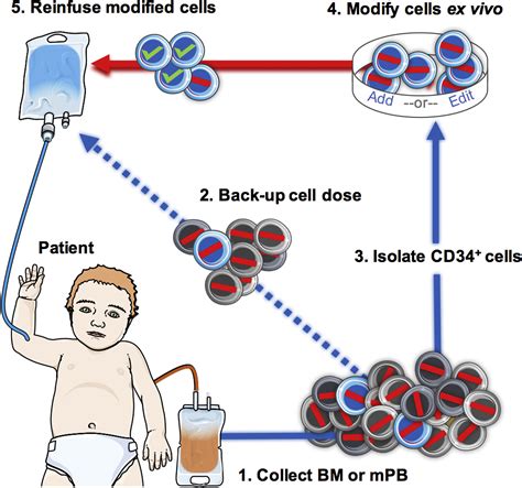 Hematopoietic Stem Cell Gene Therapy –Progress and …