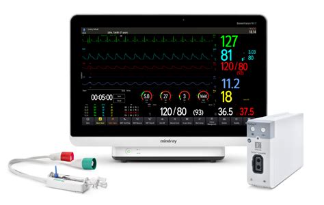 Hemodynamic Monitoring Files
