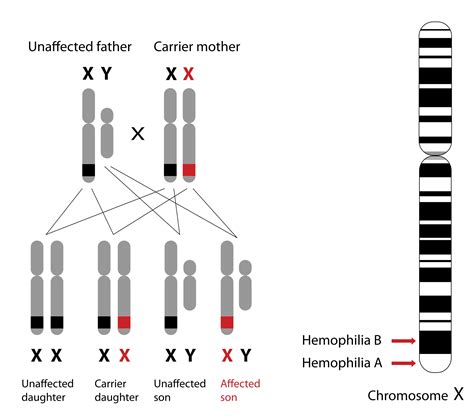 Hemofili genotipi
