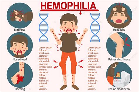 Hemofili pdf