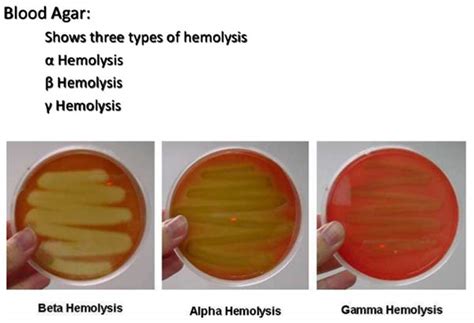 Hemolysis of Streptococci- Types and Examples with …