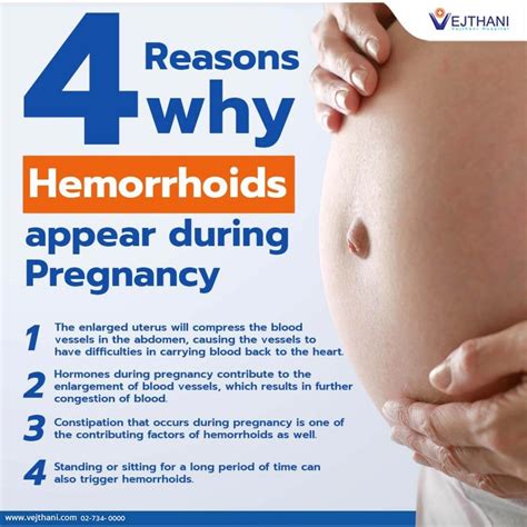 Hemorrhoids While Pregnant: Causes, Prevention