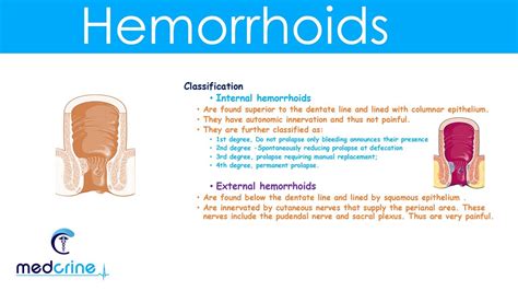 Hemorrhoids and Other Anal Disorders - American …