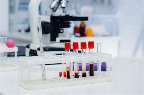 Book a lab test with Henry Ford Lab Services, Henry Ford Macomb Medical Pavilion, a clinical laboratory offering a comprehensive array of routine and specialty lab …. 