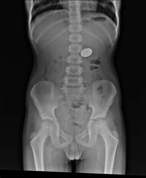 Hentai cum in stomach x-ray