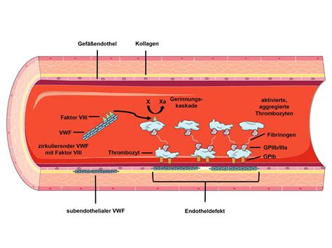 Heparin - Von Willebrand Syndrom VWS