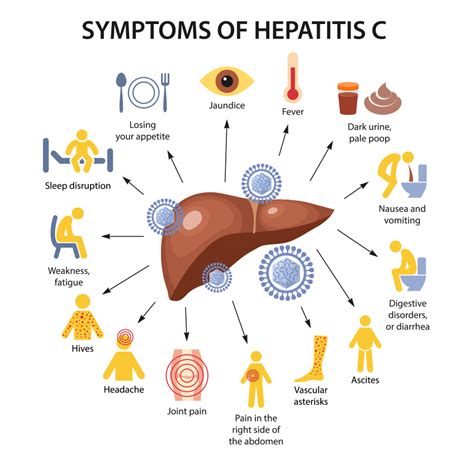 Download Hepatitis C Treatment Spot The Symptoms Early And Get Rid Of Hepatitis C Forever Hepatitis C Transmission Hepatitis C Cure Hepatitis C Symptoms  Preventing Hepatitis C By Michael Andrews