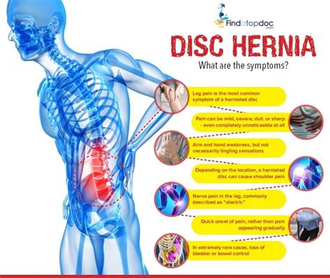 Herniated Disc And Abdominal Pain: What You …