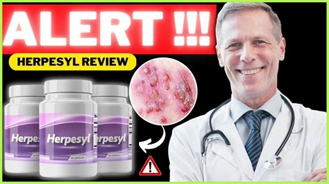 Dec 8, 2022 · Herpesyl reviews show that people were calmer and happier after using Herpesyl since it removes the discomfort from the herpes virus. Strengthens Immune System. . 