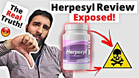 Most of the Herpesyl reviews on Reddit and YouTube contain false claims about the supplement. Is Herpesyl Available On Amazon? Herpesyl dietary supplement …. 