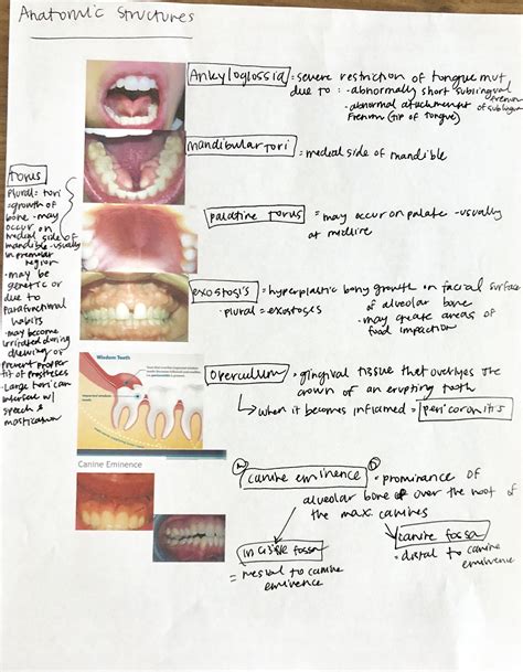Hesi study guide for dental hygiene. - Semblanza del r.p. fr. lino gómez canedo o.f.m. (1908-1990).