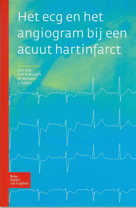 Het ecg en het angiogram bij een acuut hartinfarct. - Ssadm version 4 a users guide the mcgraw hill international series in software engineering.