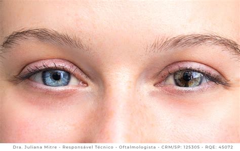 Heterocromia Onlyfans Leak