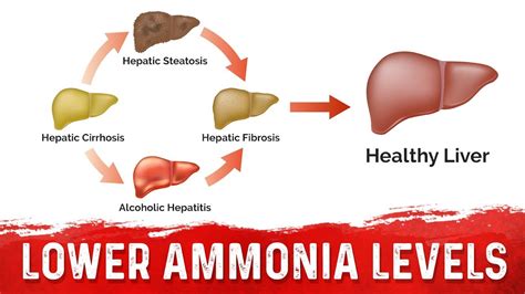 High ammonia levels in liver cirrhosis