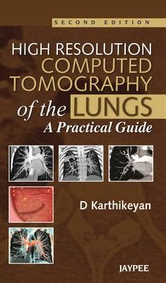 High resolution computed tomography of the lungs a practical guide. - Study guide to accompany financial accounting fundamentals.