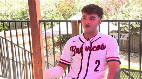 High school baseball standout loses his hand after July 4 fireworks accident