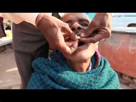 Hindistan diş tedavisi