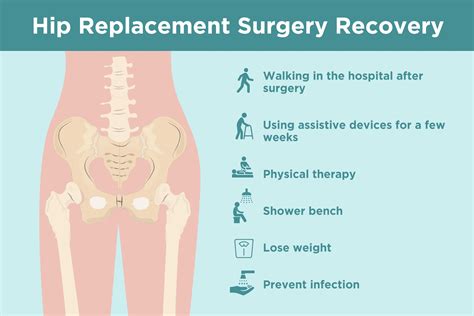 Hip replacement recovery Timings and what to expect