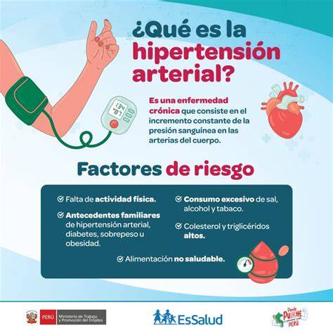 Hipertensión AG