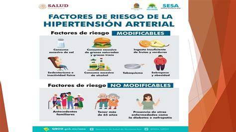 Hipertensión KFS