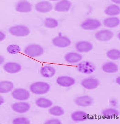 Histology, Reticulocytes Article - StatPearls