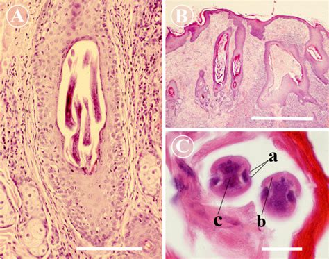 Histopathology of Pelodera dermatitis. A) A micrograph to show a... Download Scientific Diagram