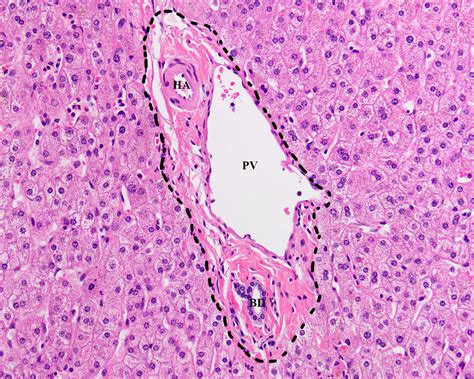 Histopathology of the liver in Down