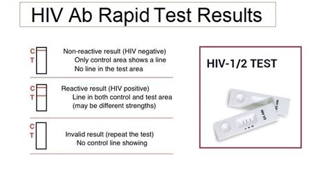 Hiv Test Results