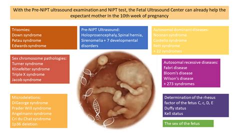 Horizon prenatal test. Things To Know About Horizon prenatal test. 