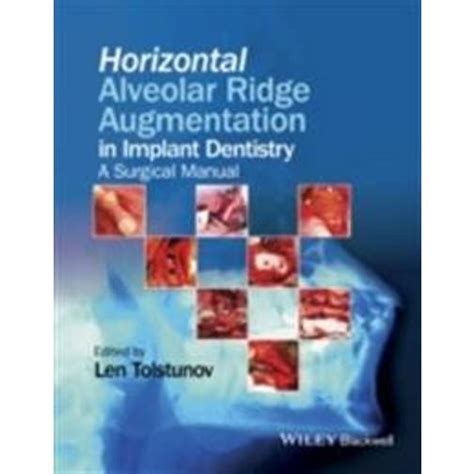 Horizontal alveolar ridge augmentation in implant dentistry a surgical manual. - Actividad y el espacio industrial en andalucía.