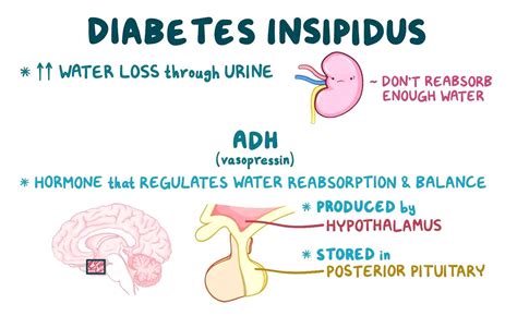 Hormones and Me Diabetes Insipidus