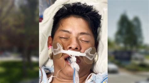 Hospital needs help identifying hit-and-run patient found in South L.A.