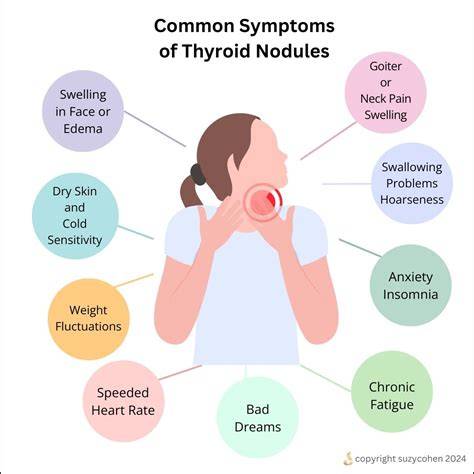 Hot thyroid nodule symptoms.  This means that only hot thyroid nodules have ...