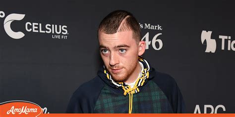 How Did Angus Cloud Get the Scar on His Head 
