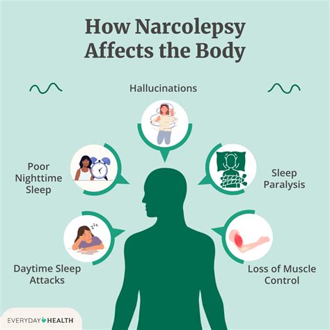 How Doctors Diagnose Narcolepsy Everyday Health