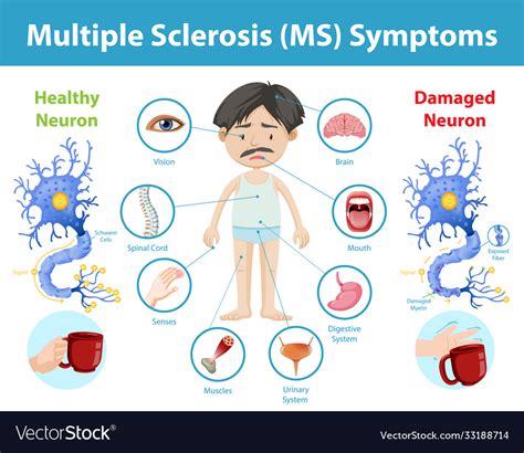 How Does Temperature Affect Multiple Sclerosis at Angus Heyward blog