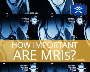 How Important Are MRIs? - PT Solutions