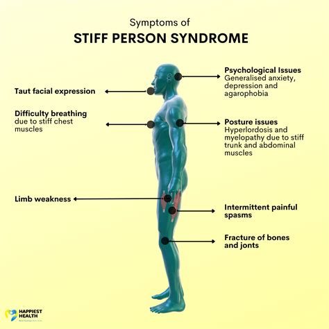 How Long Can You Live With Stiff Person Syndrome? - MedicineNet