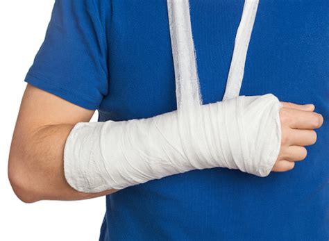 How Long Does A Fractured Broken Arm Take To Heal